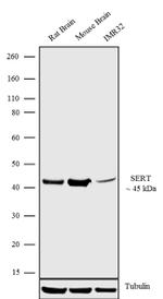 SLC6A4 Antibody in Western Blot (WB)