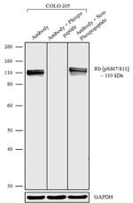 Phospho-Rb (Ser807, Ser811) Antibody in Western Blot (WB)