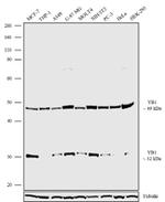 YBX1 Antibody in Western Blot (WB)