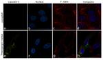 NGAL Antibody