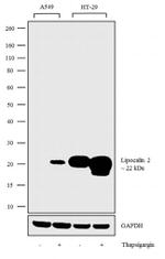 NGAL Antibody in Western Blot (WB)