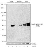 Phospho-SMAD3 (Ser423, Ser425) Antibody in Western Blot (WB)