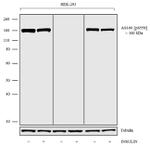 Phospho-AS160 (Ser588) Antibody in Western Blot (WB)