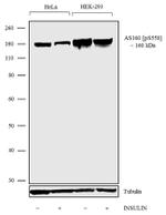 Phospho-AS160 (Ser588) Antibody in Western Blot (WB)