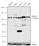 HDAC4 Antibody in Western Blot (WB)