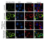 Phospho-PKC beta-1 (Thr642) Antibody