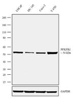 PFKFB2 Antibody in Western Blot (WB)