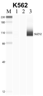 SUZ12 Antibody in RNA Immunoprecipitation (RIP)