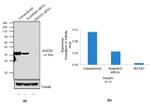 SMYD3 Antibody