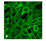 CRHR1 Antibody in Immunocytochemistry (ICC/IF)