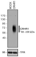 CRHR1 Antibody in Western Blot (WB)