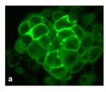 Calcitonin Receptor Antibody in Immunocytochemistry (ICC/IF)