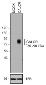 Calcitonin Receptor Antibody in Western Blot (WB)