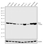 NSE Antibody in Western Blot (WB)