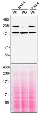 SPG11 Antibody in Western Blot (WB)