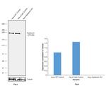 SPG11 Antibody in Western Blot (WB)