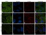 SOD1 Antibody