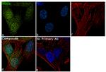 SOD1 Antibody in Immunocytochemistry (ICC/IF)