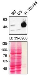 Parkin Antibody in Immunoprecipitation (IP)