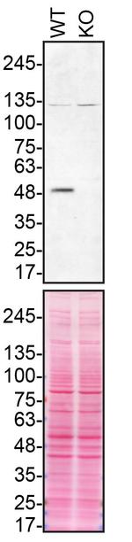 Parkin Antibody in Western Blot (WB)