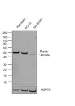 Parkin Chimeric Antibody in Western Blot (WB)