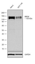 BRD8 Antibody in Western Blot (WB)