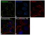 Catalase Antibody in Immunocytochemistry (ICC/IF)