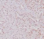 Transcription factor E3/TFE3 (Transcription Factor) Antibody in Immunohistochemistry (Paraffin) (IHC (P))