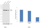 IGF2BP1 Antibody in Western Blot (WB)