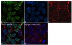 C17orf96 Antibody in Immunocytochemistry (ICC/IF)