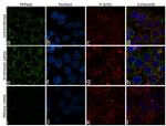 PNPase Antibody