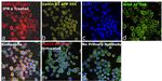 ISG15 Antibody in Immunocytochemistry (ICC/IF)