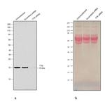 Transthyretin Antibody in Western Blot (WB)