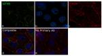 eIF4B Antibody in Immunocytochemistry (ICC/IF)