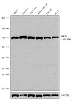 SIRT1 Antibody in Western Blot (WB)