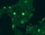 GPR30 Antibody in Immunocytochemistry (ICC/IF)