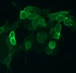 CNR2 Antibody in Immunocytochemistry (ICC/IF)