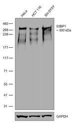 53BP1 Antibody in Western Blot (WB)