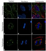 TAOK1 Antibody in Immunocytochemistry (ICC/IF)