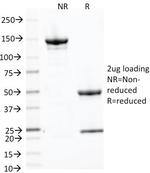 CD71/Transferrin Receptor (TFRC) Antibody in SDS-PAGE (SDS-PAGE)