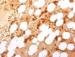 CD71/Transferrin Receptor (TFRC) (Extracellular Domain) Antibody in Immunohistochemistry (Paraffin) (IHC (P))