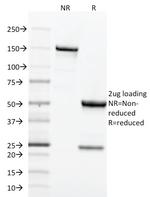 CD71/Transferrin Receptor (TFRC) (Extracellular Domain) Antibody in SDS-PAGE (SDS-PAGE)