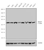 PRMT5 Antibody in Western Blot (WB)