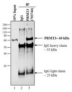 PRMT3 Antibody in Immunoprecipitation (IP)