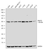 PRMT3 Antibody in Western Blot (WB)