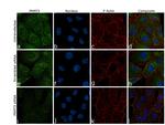 PRMT3 Antibody in Immunocytochemistry (ICC/IF)