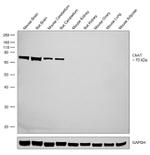 ChAT Antibody in Western Blot (WB)