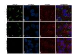 GM130 Antibody in Immunocytochemistry (ICC/IF)