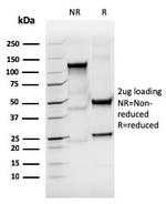 Thyroglobulin (Thyroidal Cell Marker) Antibody in SDS-PAGE (SDS-PAGE)