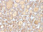 Thyroglobulin (Thyroidal Cell Marker) Antibody in Immunohistochemistry (Paraffin) (IHC (P))